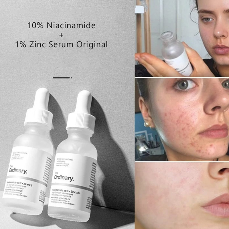The Ordinary Niacinamid 10% +  – Luxury Skincare Brands Bewertung und Preis